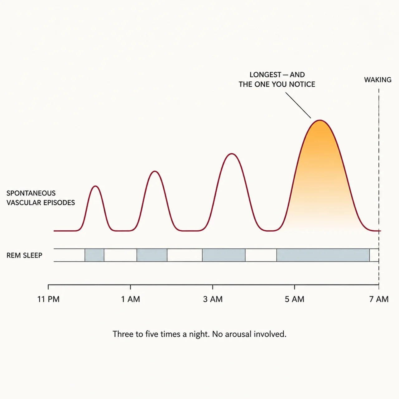 Chart of spontaneous vascular episodes through the night, three to five times with no arousal involved, the longest near waking